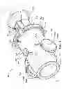 Fig. 02 - Valve with sync cam