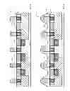 Fig. 04 - Trench silicide and gate open with local interconnect with replacement gate process
