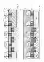 Fig. 05 - Trench silicide and gate open with local interconnect with replacement gate process