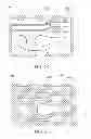 Fig. 04 - Package structure and method for manufacturing thereof