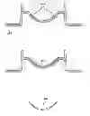 Fig. 01 - Method of ring-shaped structure placement in an eye-mountable device