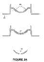 Fig. 03 - Method of ring-shaped structure placement in an eye-mountable device