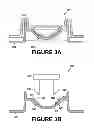 Fig. 05 - Method of ring-shaped structure placement in an eye-mountable device