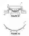 Fig. 08 - Method of ring-shaped structure placement in an eye-mountable device