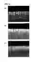 Fig. 06 - Mold, mold manufacturing method and method for manufacturing anti-reflection film using the mold
