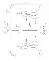 Fig. 16 - Circumferential walker