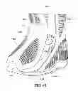 Fig. 20 - Circumferential walker