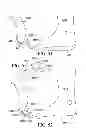 Fig. 25 - Circumferential walker