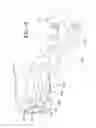 Fig. 09 - Mechanical stop for axle/suspension systems