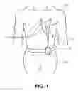Fig. 02 - Patient identification system