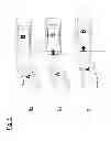 Fig. 06 - Method for preventing or reducing collision damage to a parked vehicle