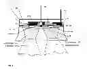 Fig. 03 - Active positioning system