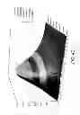 Fig. 07 - Dipole Antenna