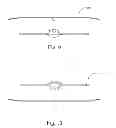 Fig. 09 - Antenna assemblies including antenna elements with dielectric for forming closed bow tie shapes