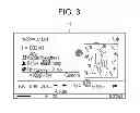 Fig. 04 - Display control device, display control method, and program