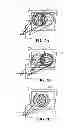 Fig. 08 - Dynamic zone plate augmented vision eyeglasses