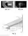 Fig. 04 - Representation and coding of multi-view images using tapestry encoding