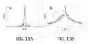 Fig. 12 - Bessel beam plane illumination microscope