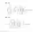 Fig. 08 - Zoom lens system