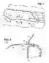 Fig. 03 - Headlamp to bumper attachment structure