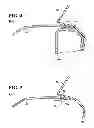 Fig. 04 - Headlamp to bumper attachment structure