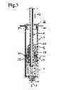 Fig. 04 - Device for Producing A Hardenable Mass