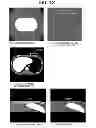 Fig. 10 - X-ray CT device, and method