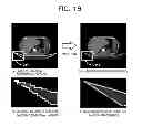 Fig. 14 - X-ray CT device, and method