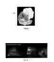 Fig. 06 - Excised specimen imaging using a combined PET and micro CT scanner