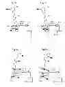 Fig. 04 - Adapting a scan motion in an x-ray imaging apparatus
