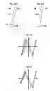 Fig. 08 - Adapting a scan motion in an x-ray imaging apparatus
