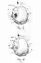 Fig. 04 - Microphone environmental protection device