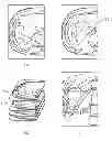 Fig. 01 - SEGMENTATION METHOD OF MEDICAL IMAGE AND APPARATUS THEREOF