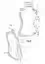 Fig. 04 - POUCH ANTI-SAG MEASURES
