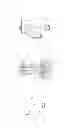 Fig. 02 - Positive Displacement Pump Including Detectable Composite Non-Metallic Components