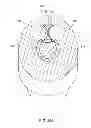 Fig. 33 - Ball seat apparatus and method