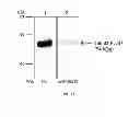 Fig. 13 - Methods and compositions for modulation of Olfml3 mediated angiogenisis