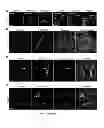 Fig. 15 - Methods and compositions for modulation of Olfml3 mediated angiogenisis