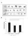 Fig. 28 - Methods and compositions for modulation of Olfml3 mediated angiogenisis