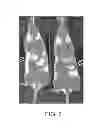 Fig. 08 - Compositions and Methods for in Vivo Imaging