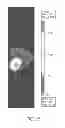 Fig. 14 - Compositions and Methods for in Vivo Imaging