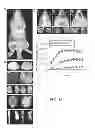 Fig. 19 - Compositions and Methods for in Vivo Imaging