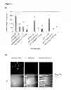 Fig. 07 - METHOD OF REDUCING MULTI-DRUG RESISTANCE USING INOSITOL TRIPYROPHOSPHATE
