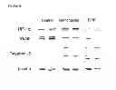 Fig. 12 - METHOD OF REDUCING MULTI-DRUG RESISTANCE USING INOSITOL TRIPYROPHOSPHATE