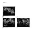 Fig. 13 - METHOD OF REDUCING MULTI-DRUG RESISTANCE USING INOSITOL TRIPYROPHOSPHATE