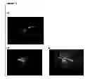 Fig. 15 - METHOD OF REDUCING MULTI-DRUG RESISTANCE USING INOSITOL TRIPYROPHOSPHATE