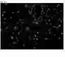 Fig. 13 - NUTRITIONAL COMPOSITIONS CONTAINING A NEUROLOGIC COMPONENT AND USES THEREOF