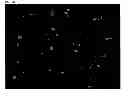 Fig. 16 - NUTRITIONAL COMPOSITIONS CONTAINING A NEUROLOGIC COMPONENT AND USES THEREOF