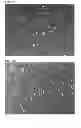 Fig. 17 - NUTRITIONAL COMPOSITIONS CONTAINING A NEUROLOGIC COMPONENT AND USES THEREOF