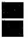 Fig. 19 - NUTRITIONAL COMPOSITIONS CONTAINING A NEUROLOGIC COMPONENT AND USES THEREOF